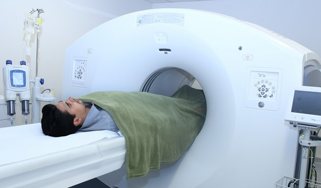 Covid-19: Alagoas vai disponibilizar tomografia gratuita para a população 