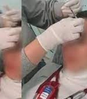 Médicas são demitidas após serem flagradas aplicando botox uma na outra