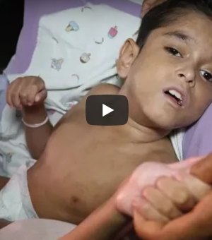 [Vídeo] Família pede ajuda para menino de nove anos com síndromes raras