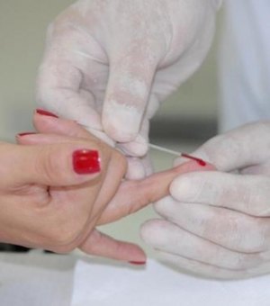 Sesau vai capacitar municípios para realização do Teste Rápido de HIV e sífilis