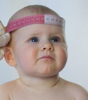 Responsáveis por bebês com microcefalia terão direito a auxílio do INSS