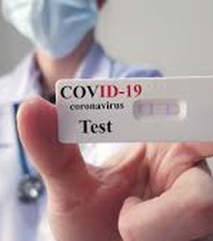 Com 859 novos casos, Alagoas chega a 47.864 infectados com Covid-19
