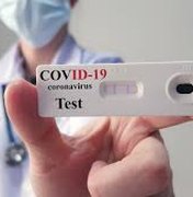 Com mais 966 casos da Covid-19, AL chega a 46.296 infectados