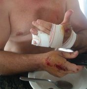 Fotógrafo é atacado por 5 cachorros quando transitava em motocicleta, em Arapiraca