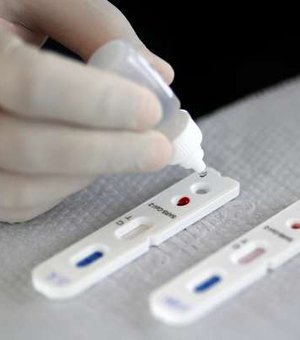 Governo do Japão aprova novo teste de anticorpos para covid-19