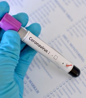 Arapiraca vai  comprar  mais 15 mil testes para a realização do diagnóstico de Covid-19