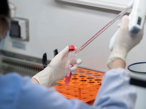 Fiocruz vai produzir 2,4 milhões de testes para diagnosticar coronavírus