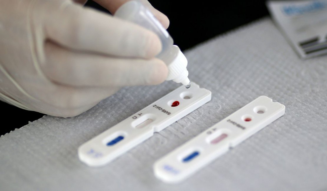 Britânicos que produzem vacina farão testes com 10 mil pessoas