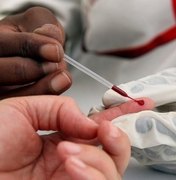 Brasil tem 827 mil vivendo com HIV; 112 mil não sabem que estão infectados