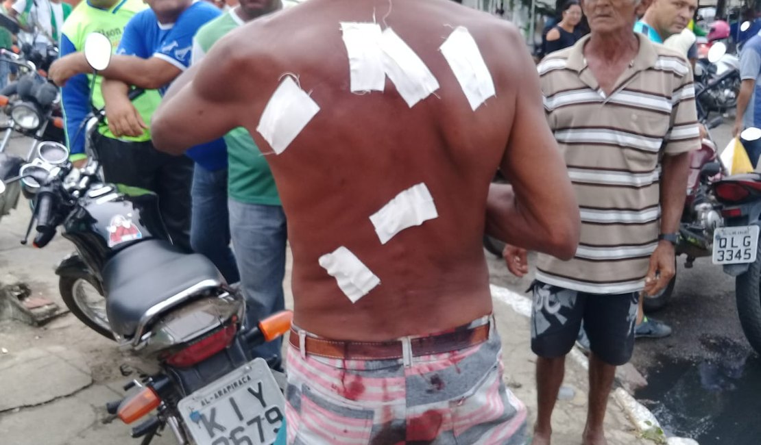 Trabalhador leva facadas nas costas na feira de Arapiraca