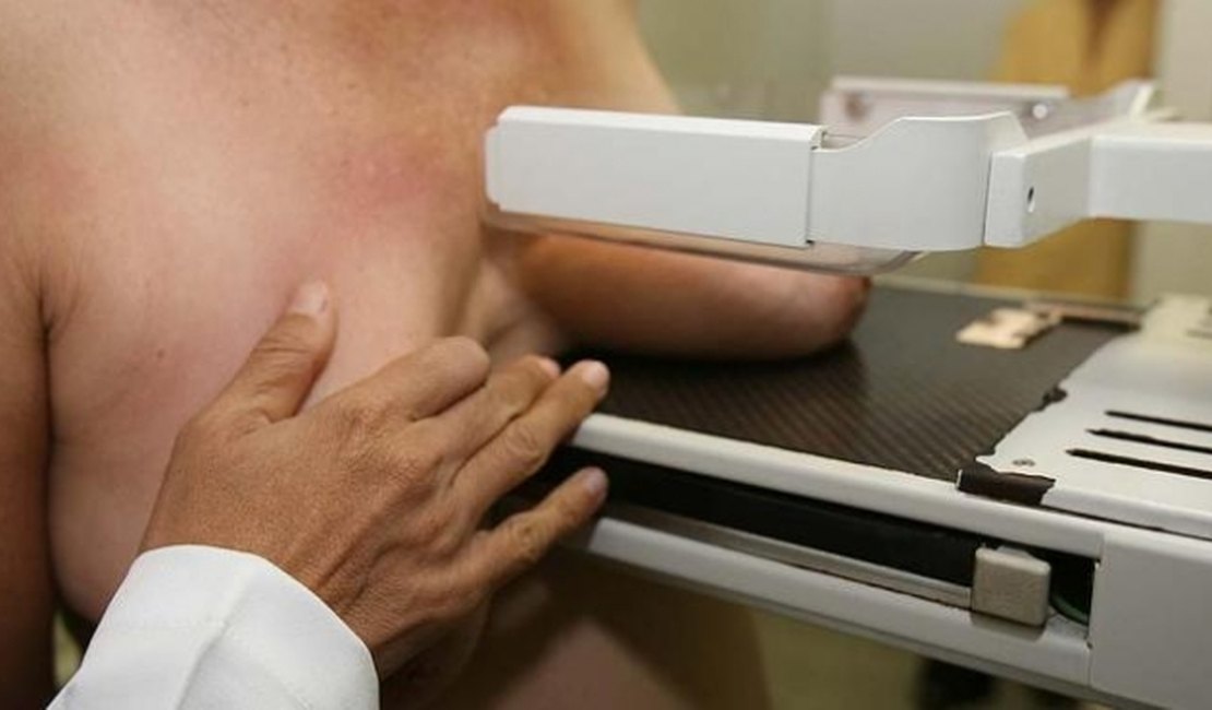 Número de mamografias aumenta em 37% no país