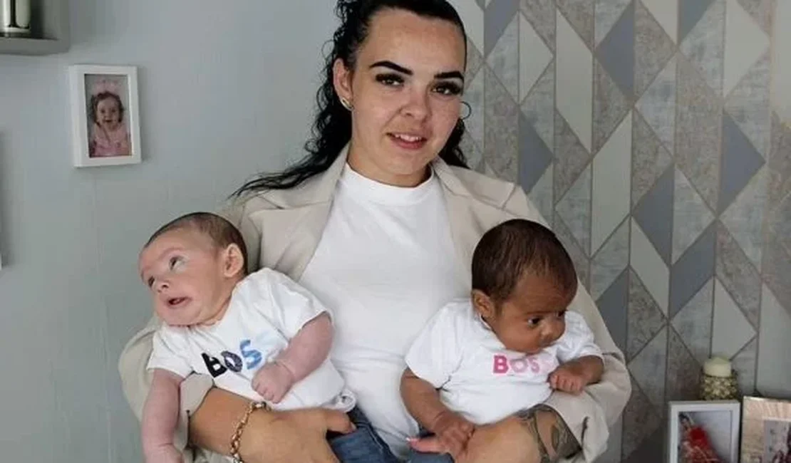 Mulher dá à luz gêmeos com tons de pele completamente diferentes
