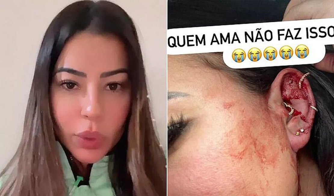 [Vídeo] Influenciadora de Penedo denuncia agressão do namorado e recebe solidariedade de Carlinhos Maia