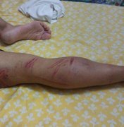 Soldado perde testículo após sessão de tortura no alojamento do Exército