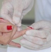 Secretaria de Saúde promove mutirão de exames laboratoriais