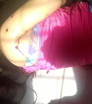 Mulher baleada por militar em 'surto psicótico' morre no HGE