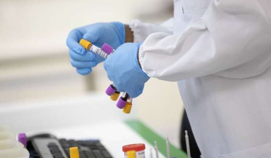 Alagoas tem 89.493 casos da Covid-19 e 2.177 óbitos