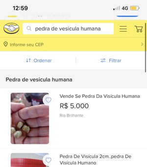 Brasileiros utilizam plataformas de venda online para comercializar pedras de vesícula