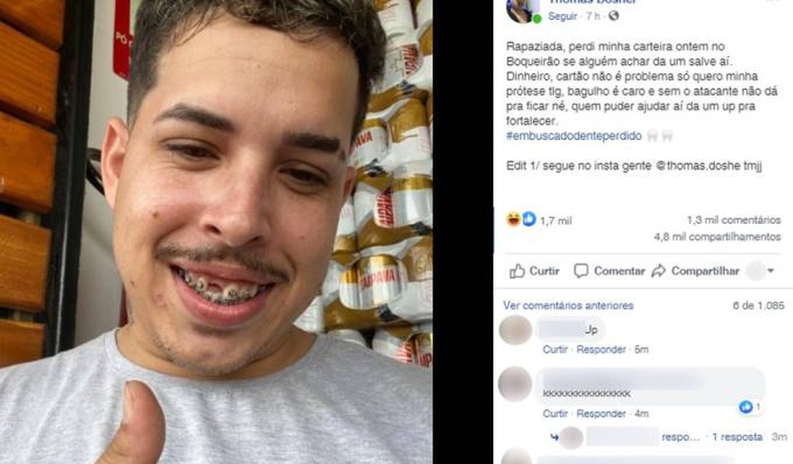 Rapaz perde dente da frente, faz pedido na internet e viraliza