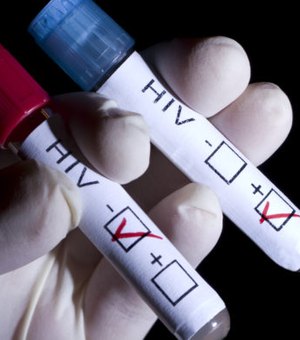 Comprimido que previne contaminação de HIV será oferecido pelo SUS