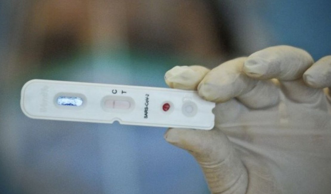 Covid-19: Alagoas tem 66.748 casos e 1.665 óbitos pela doença