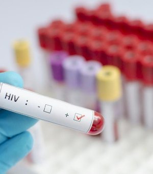 Alerta: 135 mil convivem com HIV no Brasil e não sabem