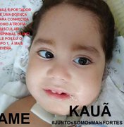 Doação: mãe precisa de R$ 3 milhões para tratamento de criança com doença rara, em Maceió