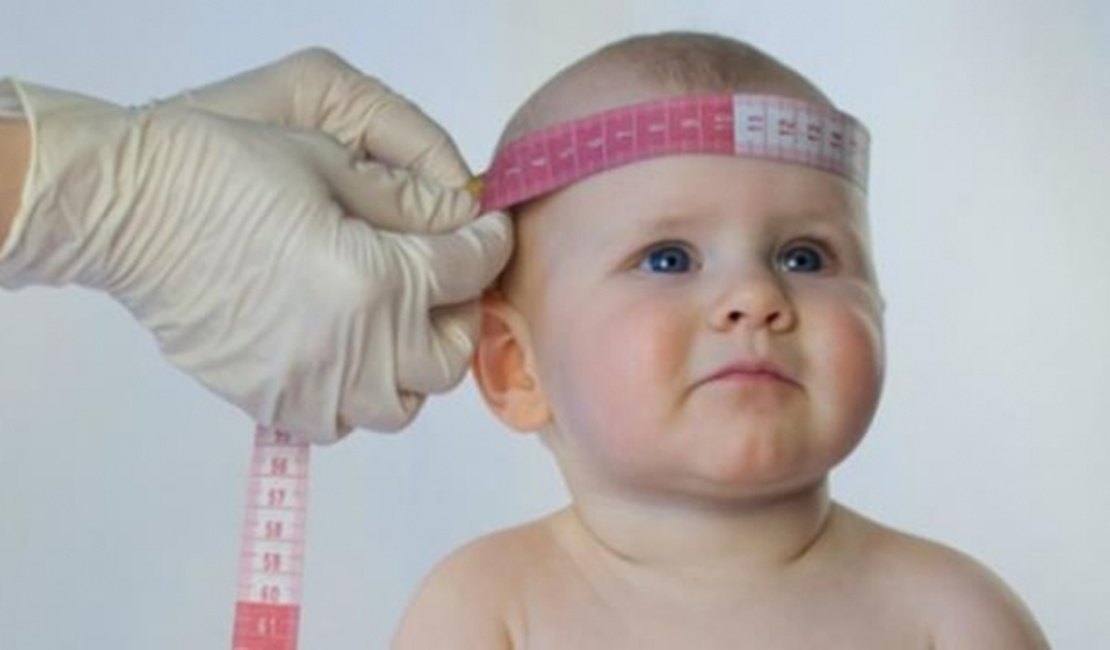 Responsáveis por bebês com microcefalia terão direito a auxílio do INSS