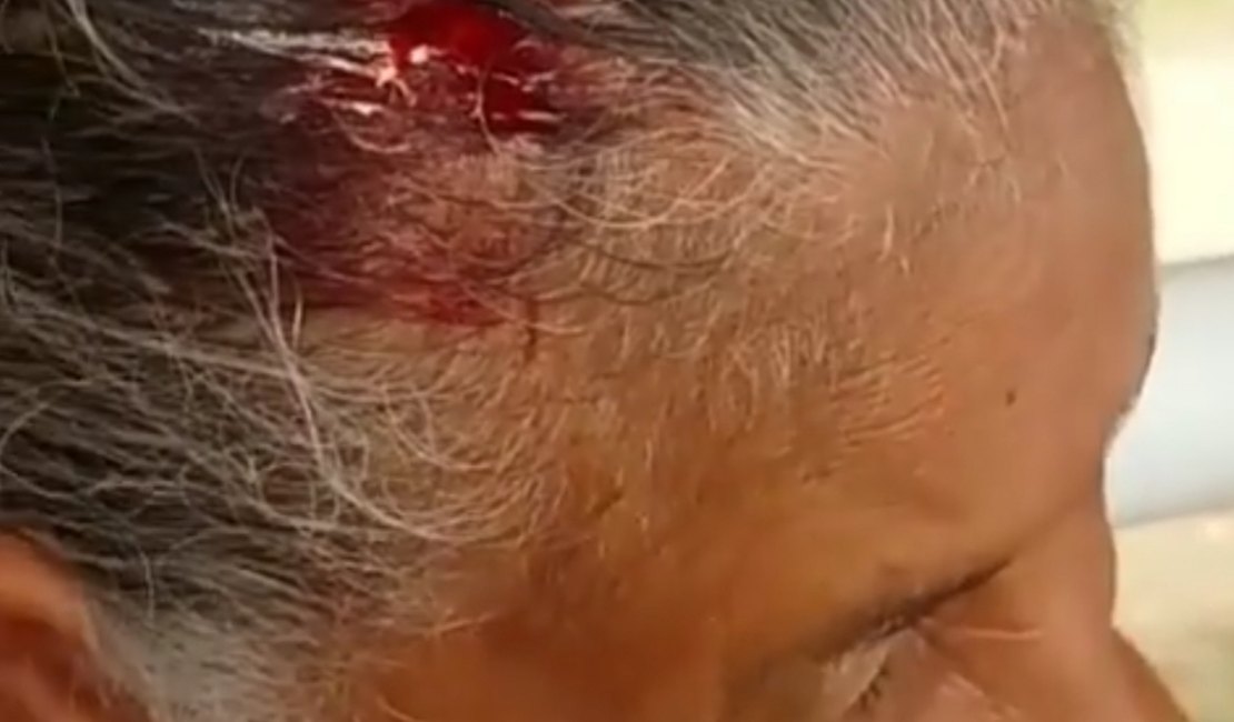 [Vídeo] Idosa sofre corte na cabeça em estrutura de terminal em Arapiraca