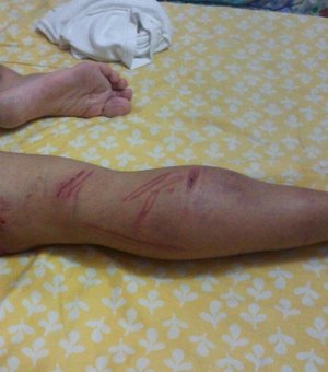 Soldado perde testículo após sessão de tortura no alojamento do Exército