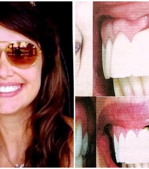 Dentista é condenada a pagar mais de R$ 50 mil por implante mal feito