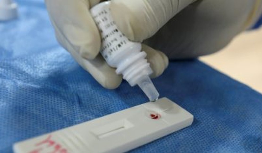 Arapiraca tem 114 novos casos de Covid-19 e chega a 2.437 infectados