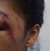 Mulher é agredida no rosto pelo marido em Maceió