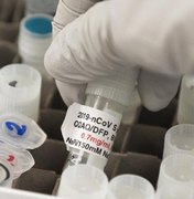 EUA, Reino Unido e Canadá acusam Rússia de tentar roubar dados sobre vacina para Covid-19