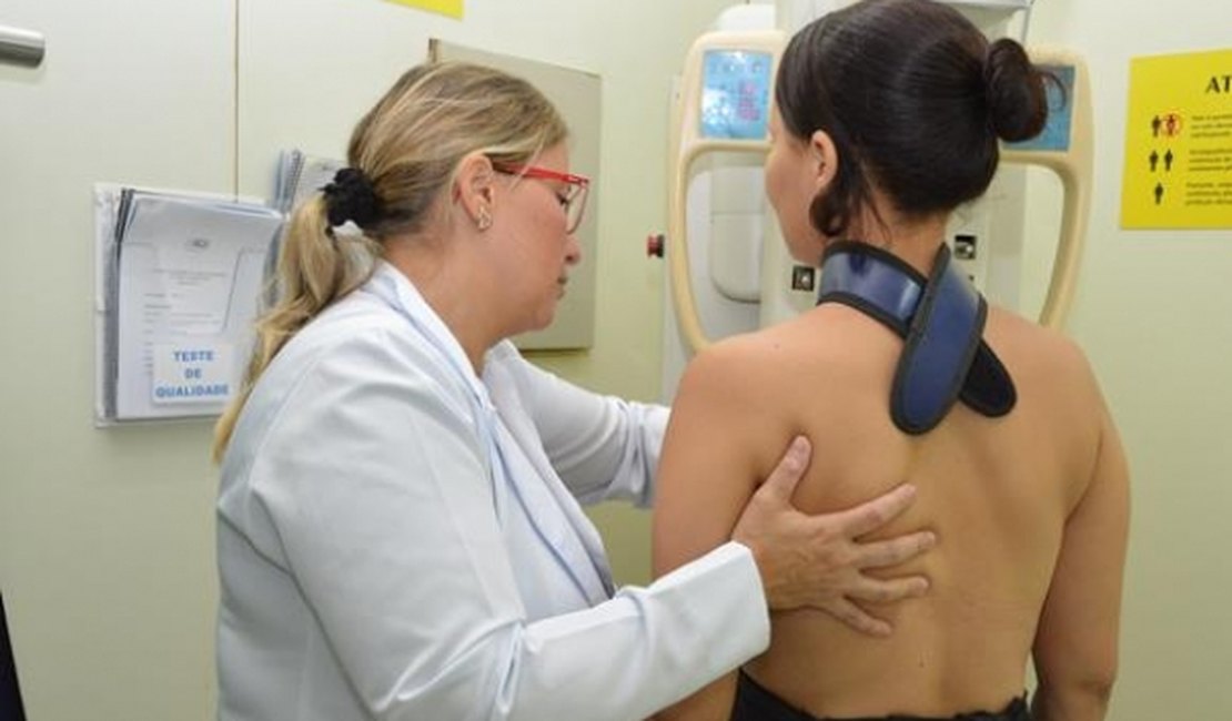 Sesau orienta municípios a ampliarem oferta de mamografia bilateral