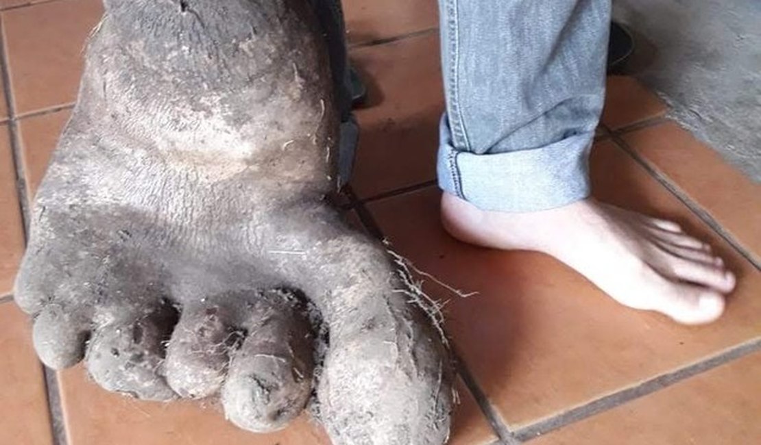 Batata com formato de pé? Casal encontra tubérculo de 8kg