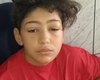 Mãe pede ajuda para custear tratamento do filho de 12 anos que perdeu 100% da visão por inflamação na córnea