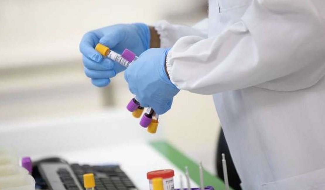 Arapiraca continua a ser epicentro da pandemia de Covid-19 em Alagoas
