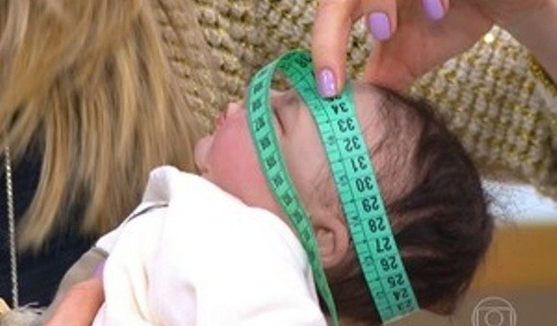 Hospital Helvio Auto inicia atendimento a bebês com microcefalia