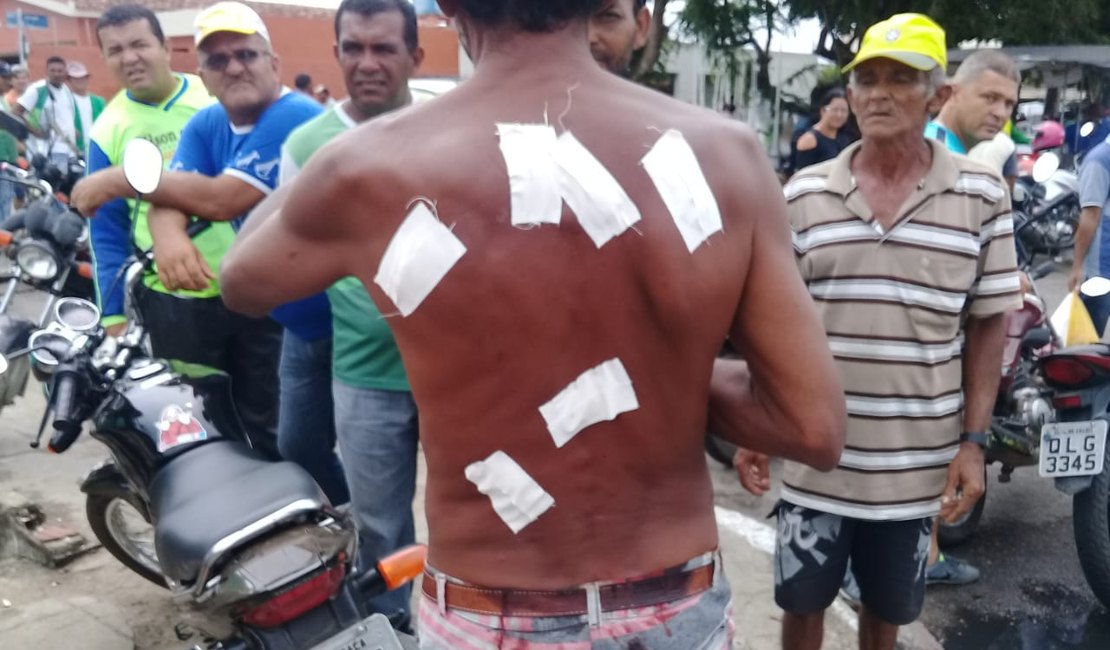 Trabalhador leva facadas nas costas na feira de Arapiraca