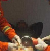 Bombeiros são acionados para retirar anéis presos em órgão genital masculino