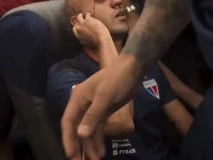 Ônibus do Fortaleza é atacado por torcedores do Sport; jogadores são feridos e levados a hospital