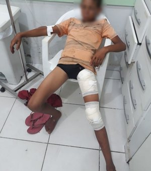 Menor de 14 anos é alvejado com tiro de espingarda em União dos Palmares