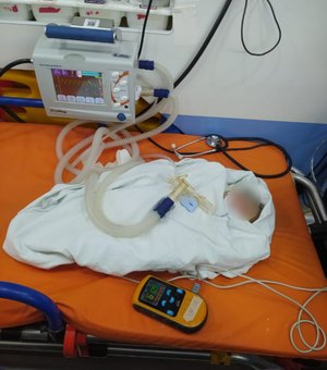Bebê é internado em estado grave após nascer sem sinais vitais