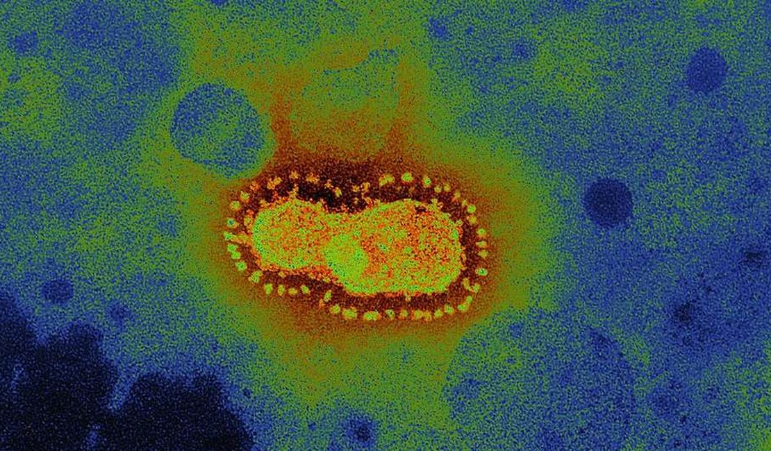 Nível de anticorpos cai rapidamente após infecção, apontam estudos