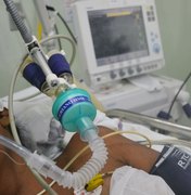 Hospital Helvio Auto reduz a zero pneumonias associadas à intubação de pacientes