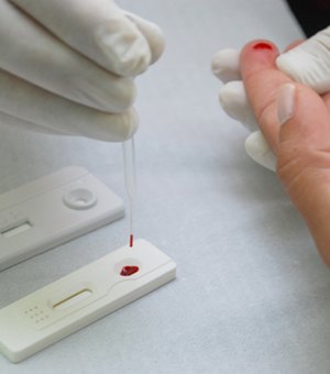 Julho Amarelo: campanha alerta para importância da testagem para hepatites virais