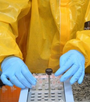 Estado vai ampliar exame de RT-PCR para alagoanos com síndrome gripal
