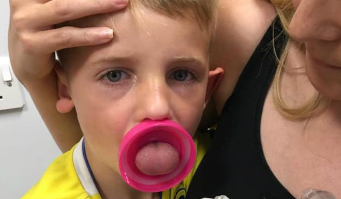 Menino de 6 anos passa por cirurgia após ficar com a língua presa em garrafa