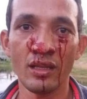 Homem é atacado durante pescaria por sucuri de 3 metros que o atinge no rosto